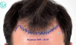 fue漫画,探索未来科技与人类命运的奇幻之旅